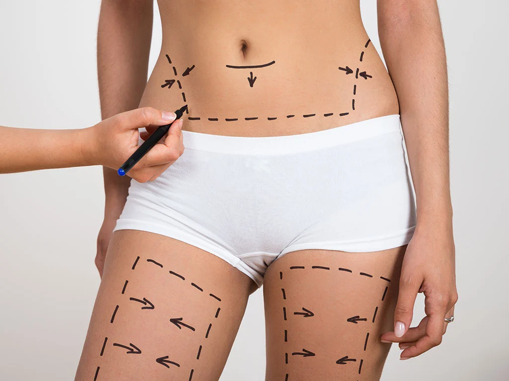 پیکر تراشی چگونه انجام میگیرد؟