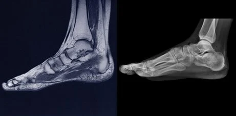 What causes foot pain