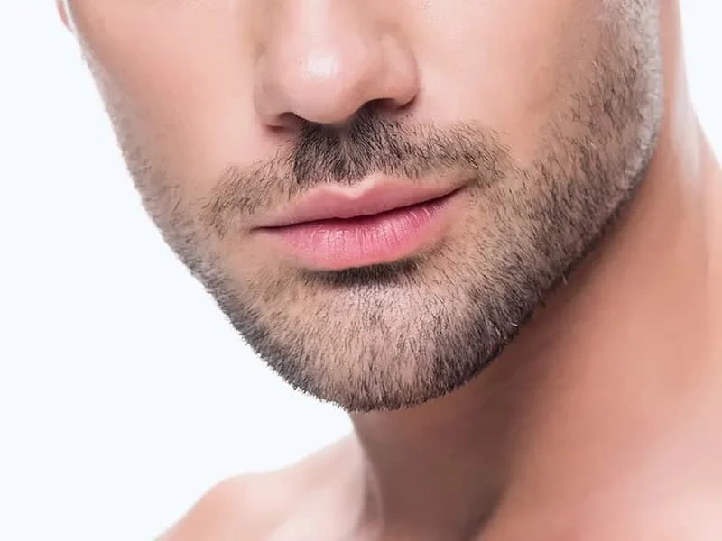 زاویه سازی فک با تزریق ژل چگونه است؟