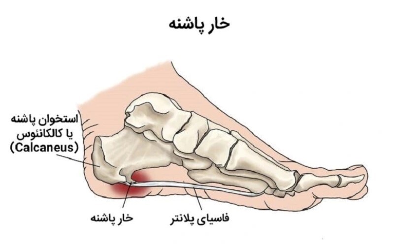 انواع بیماری‌های مربوط پا