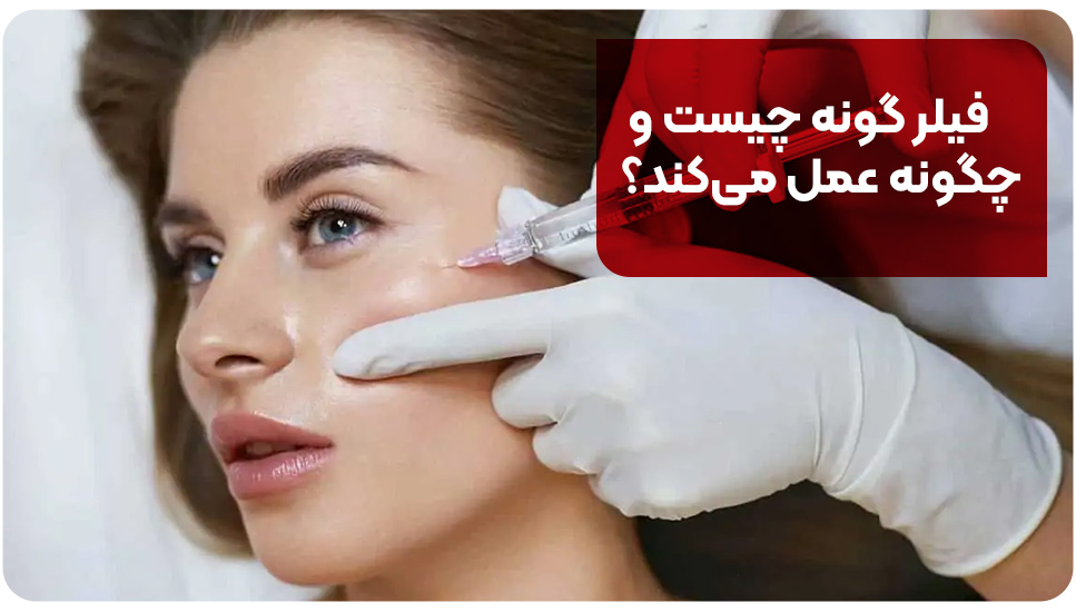 فیلر گونه چیست و چگونه عمل می‌کند؟