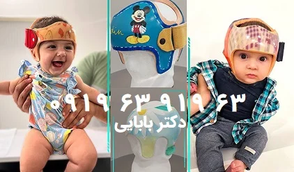 اصلاح فرم سر نوزاد در خانه اصلاح فرم سر نوزاد در خانه