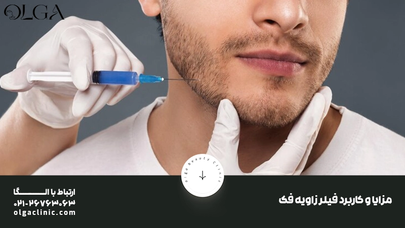 فیلر زاویه فک فیلر زاویه فک مردانه