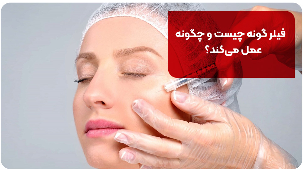فیلر گونه چیست و چگونه عمل می&zwnj;کند؟